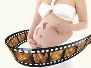 廊坊四维彩超是怎么做的